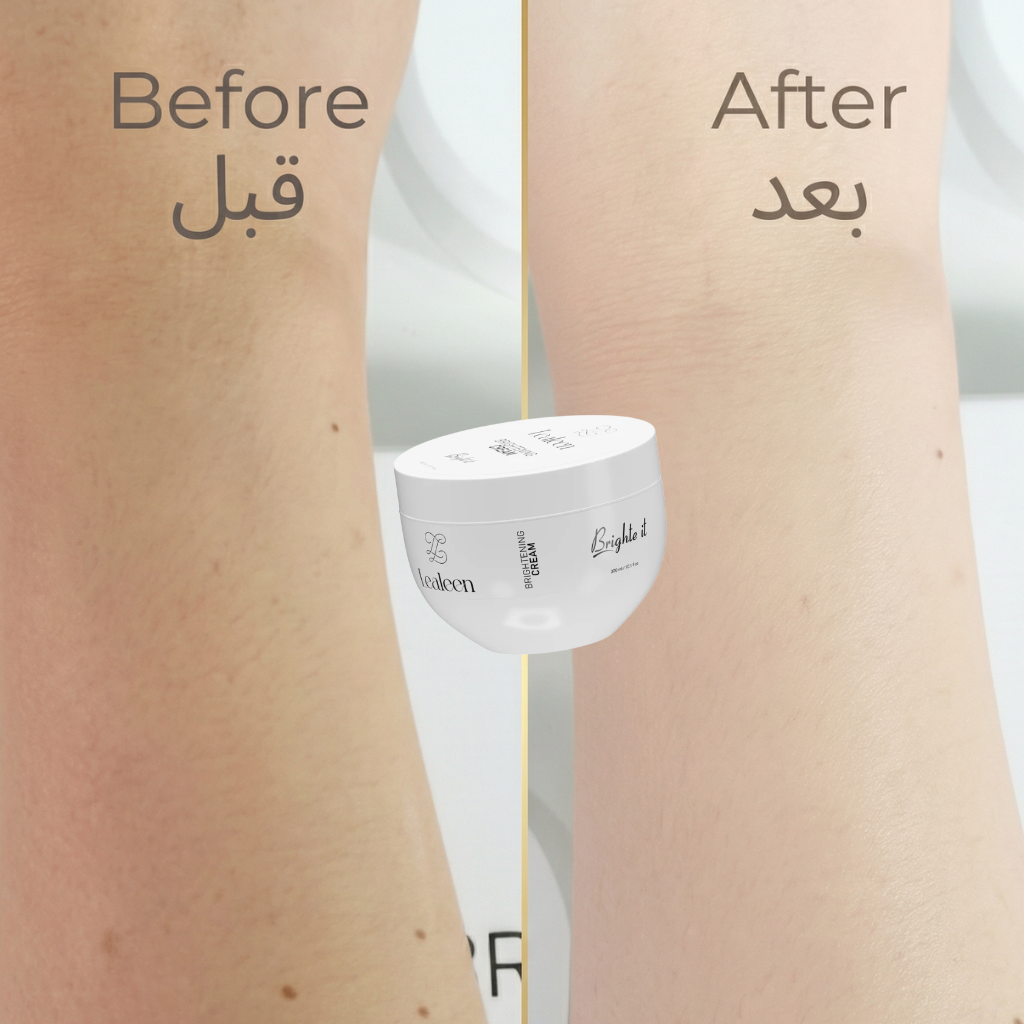 Instant Whitening Body Cream | Niacinamide &amp; Vitamin C | 300ml